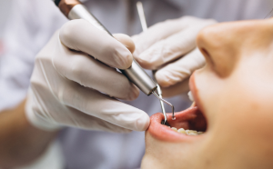 松山區牙醫推薦