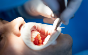 松山區牙醫推薦