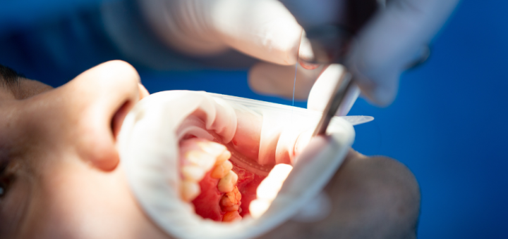 松山區牙醫推薦